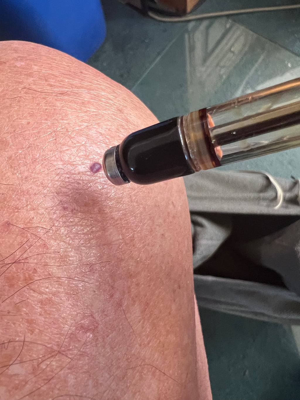 DermaSeptic Active Silver Ion Skin Care Instrument
